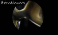 Uretrocistoscopia